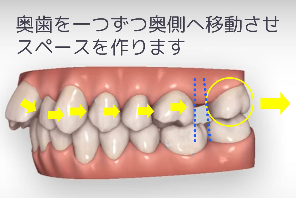 遠心移動